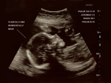 God Is Not Silent on Abortion